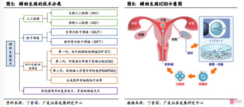 輔助生殖技術(shù)分類和ICSI單精子注射的流程操作