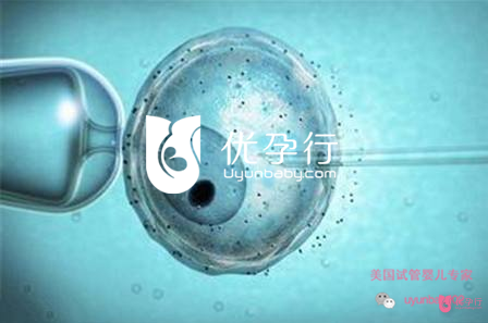 美國試管嬰兒