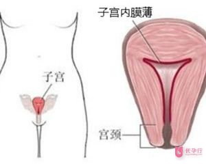 子宮內(nèi)膜薄(2).jpg