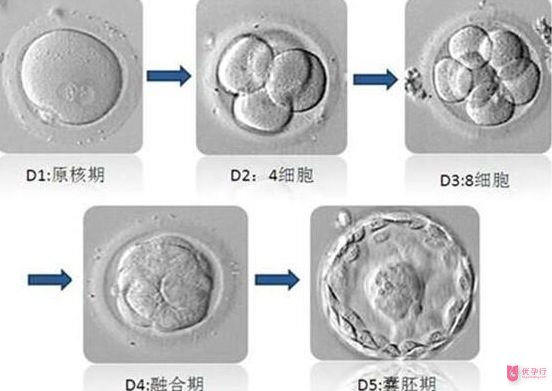 美國試管嬰兒