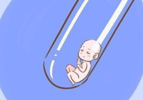 試管嬰兒取精過程是怎樣的 - 第三代試管嬰兒